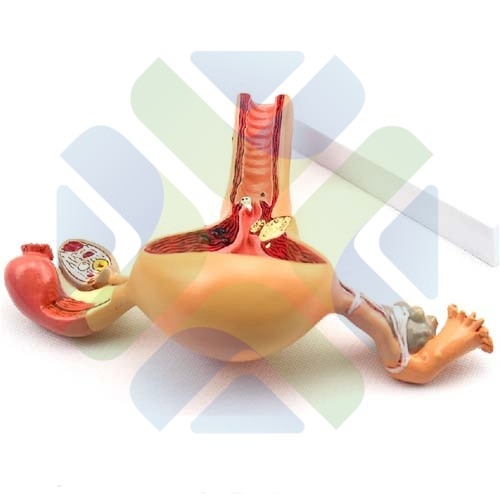 MODELO ANATOMICO DE TERO CON PATOLOGIAS 