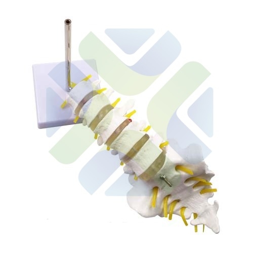 VERTEBRA LUMBAR