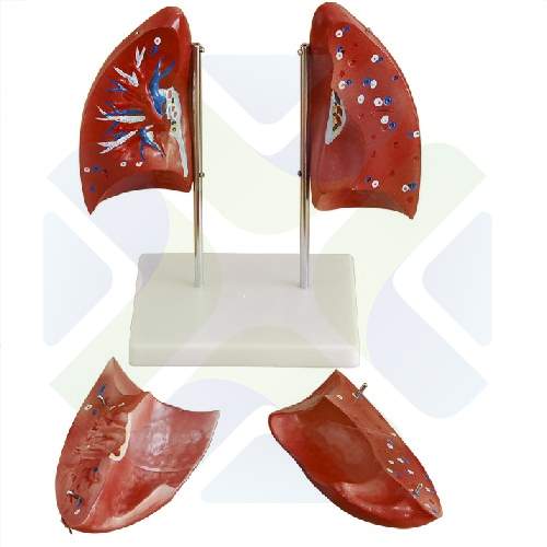 MODELO ANATOMICO PULMONES